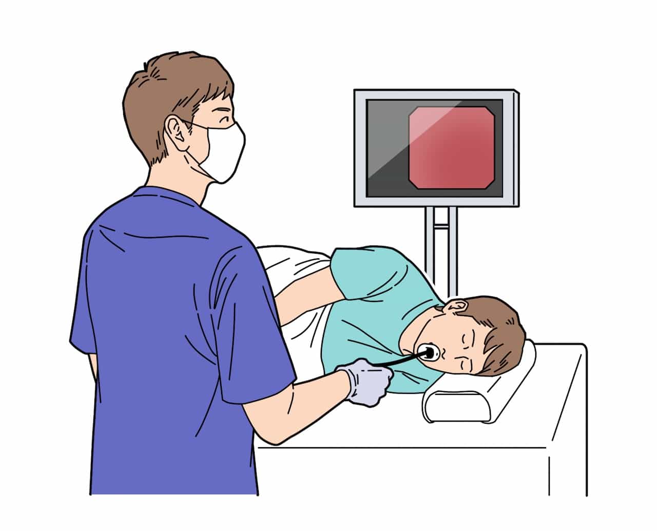 内視鏡検査のイメージ