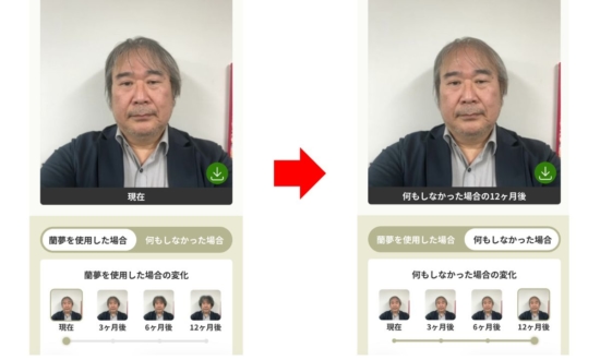 将来の薄毛具合をAIで無料シミュレーション！手がけたのは洋ランの世界的栽培業者！その理由とは